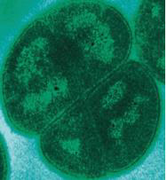 Deinococcus radiodurans[위키피디아 제공]